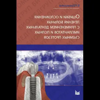 Ошибки и осложнения лечения больных с применением дентальных имплантов и полных съемных протезов.