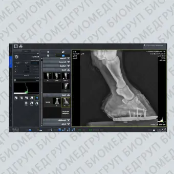 Программное обеспечение рентгенографии VXvue with PureImpact