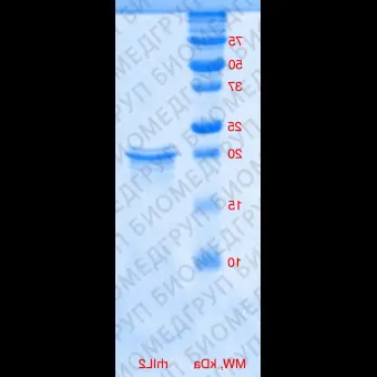 Интерлейкин 2 человека, рекомбинантный белок, rhIL2, Россия, PSG21010, 10 мкг