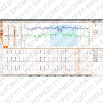 Медицинское программное обеспечение CubeHolter WS