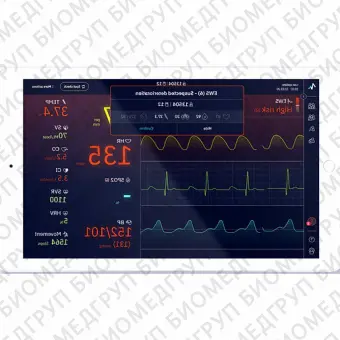 Медицинское программное обеспечение EWS