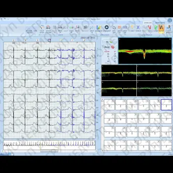 Программное обеспечение для холтеровского монитора EUROHOLTER SW3/12