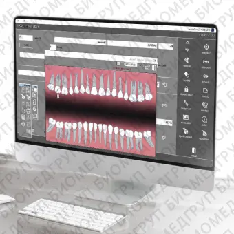 Программное обеспечение для обработки снимков зубов Quickvision