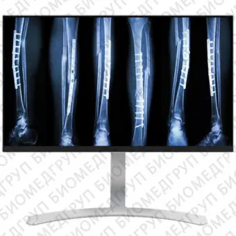 Double Black Imaging 27 8MP Color Clinical LED Медицинский монитор