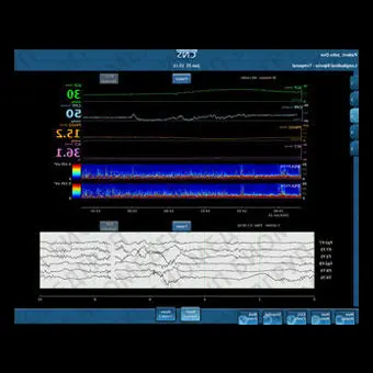 Медицинское программное обеспечение CNS Monitor