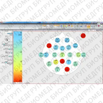 Программное обеспечение для ЭКГ ProFusion