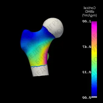 Программное обеспечение для остеоденситометрии 3DDXA