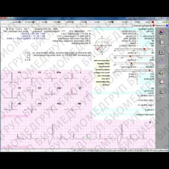 Программное обеспечение для электрокардиографии CVS03