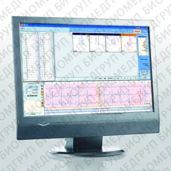 Медицинское программное обеспечение AFib Detection