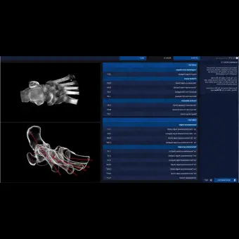 Медицинское программное обеспечение Disior Bonelogic Ortho