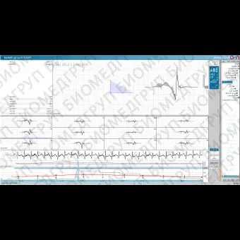 Программное обеспечение для диагностической станции сердечнодыхательной деятельности PADSY Ergo