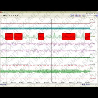 Полисомнограф с EEG SleepScout