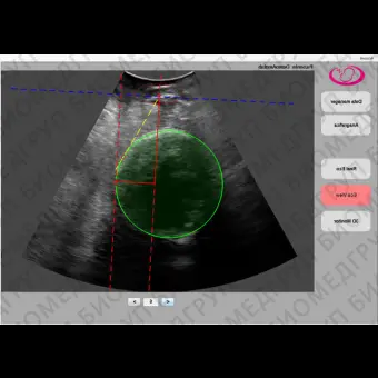 Программное обеспечение для ультразвуковых исследований Amolab Suite