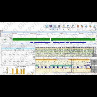 Полисомнограф с EEG NEURONSPECTRUM65/PSG