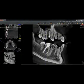 Программное обеспечение для обработки снимков зубов QuickVision 3D