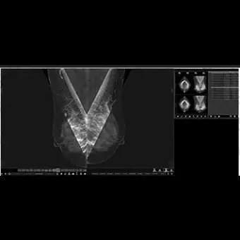 Информационная рабочая станция для маммографии MammoVU