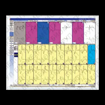 Медицинское программное обеспечение Cardy Analyzer05