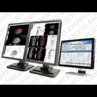 Программное обеспечение для медицинских снимков SUITESTENSA RIS PACS