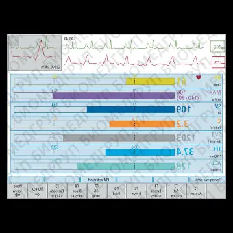 Электрокардиограф для спокойного состояния CardioScreen 2000