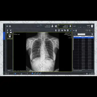 Программное обеспечение рентгенографии VXvue with PureImpact