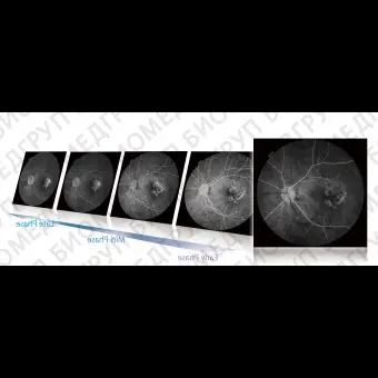 Фундускамера гибридная TRCNW8F для скрининговых исследований, флуоресцентной ангиографии