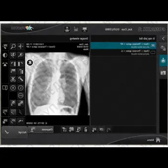 Программное обеспечение для медицинских снимков CONAXX 2