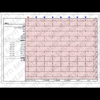 Ветеринарная ЭКГсистема 12 каналов DE12VET