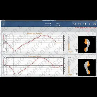 Переносная стабилометрическая платформа Presscam