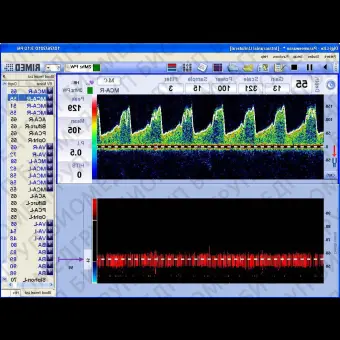 Трансчерепной доплер DigiOne