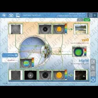 Роговичный топограф OPDScan III VS