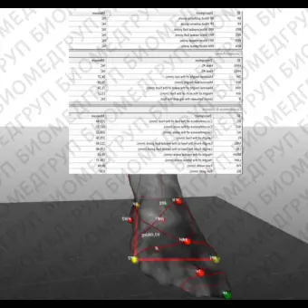 Система оценки походки Dynamic FootMorphology