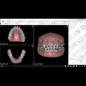 Программное обеспечение для обработки снимков зубов NemoCast