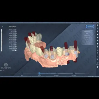 Программное обеспечение для лабораторий DentalCad