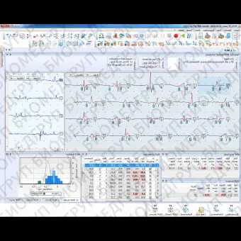 Электромиограф 5 каналов SKYBOX