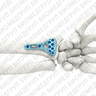 Компрессионная костная пластина лучевая кость ARIX 2.5