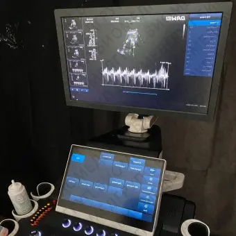 Ультразвуковой сканер на платформе DWT50