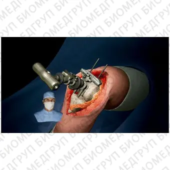 Медицинский симулятор для ортопедической хирургии SimOrtho