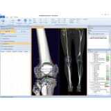 Медицинское программное обеспечение mediCAD 3D Knee