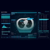 Медицинское программное обеспечение CT Lung