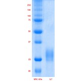 Интерлейкин 7 человека, рекомбинантный белок, rhIL-7, Россия, PSG240-50, 50 мкг
